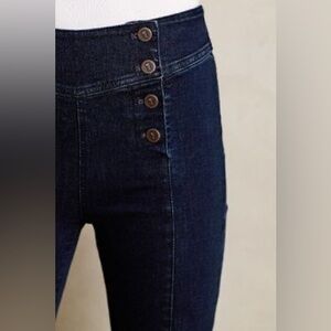 Pilcro & The Letterpress “Jenna” High Rise Skinny Jeans With Side Button Detail